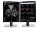 Barco Nio C 5.8MP MDNC-6121 Dual 21" Diagnostic Monitors – DICOM