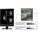 EIZO RadiForce RX560 21.3" QXGA 5MP LED LCD Medical Monitor – 1100 cd/m², 4:3, DVI/DisplayPort, Black