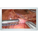 26IN 1920X1080 1400:1 EX2620 EIZO INC