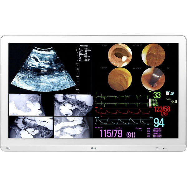 32 LG MEDICAL IPS 4K SURGICAL MONITOR, 3480X2160, HDMI DP USB, HDR10 DICOM HW CA