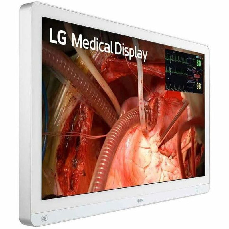 27  LG MEDICAL VA 4K SURGICAL MONITOR, 3840 X 2160, DVI-D, HDMI, WHITE, SRGB 139