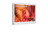LG 27HS714S-W 27" 4K Mini-LED Surgical Monitor with 12G-SDI, Optical Bonding, IP45 Front