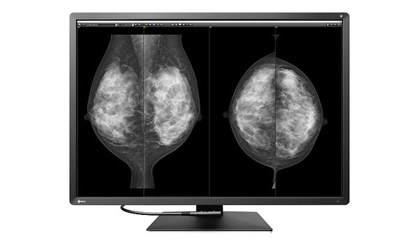 EIZO RadiForce RX1270-BK 30.9" 12MP Color Medical Diagnostic Monitor - IPS, DICOM Part 14, 1500:1, 1200 cd/m², DisplayPort/HDMI - Black