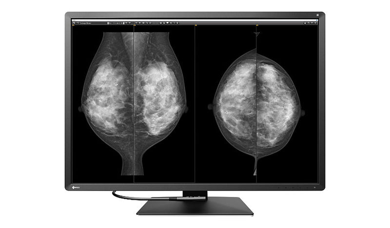 EIZO RadiForce RX1270-BK 30.9" 12MP Color Medical Diagnostic Monitor - IPS, DICOM Part 14, 1500:1, 1200 cd/m², DisplayPort/HDMI - Black
