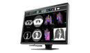EIZO RadiForce RX1270-BK 30.9" 12MP Color Medical Diagnostic Monitor - IPS, DICOM Part 14, 1500:1, 1200 cd/m², DisplayPort/HDMI - Black