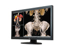 JVC CCL650i2 6MP 30-inch Medical Diagnostic Monitor – High Brightness & Precision Imaging