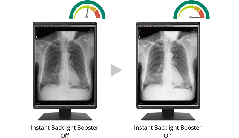 EIZO RadiForce RX370-BK 21.3" 3MP Color Medical Diagnostic Monitor with DICOM Part 14 Compliance and Work-and-Flow Technology