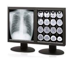Sony LMD-DM30 3MP Diagnostic Grayscale Monitor – High Precision