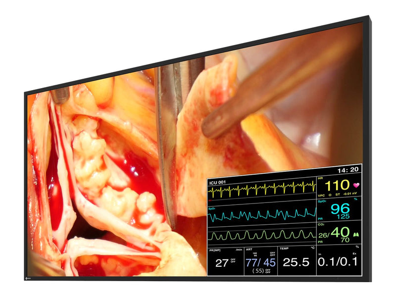 EIZO CuratOR LX491W-BK 48.5" Full HD Surgical LCD Monitor - 16:9 - Black