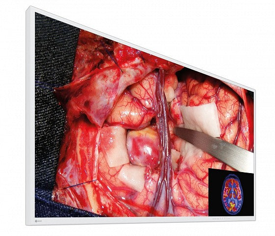EIZO CuratOR EX5542 55" 4K UHD Surgical LCD Monitor with BT.2020 Wide Color Gamut and HDR Support