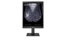 LG 21.3-inch 5MP IPS Diagnostic Monitor for Mammography