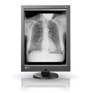 Eizo Gx340-cl-p Eizo Radiforce Lcd Monitor 3mp Grayscale 22