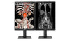 LG 21HQ513D-S 21.3" 3MP IPS Diagnostic Medical Monitor, 1,100 cd/m², DICOM Compliant